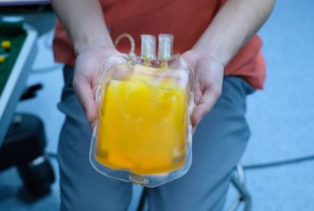 Covid-19 Mereda, PMI Surabaya akan Kirim Stok Plasma Konvalesen ke Luar Negeri