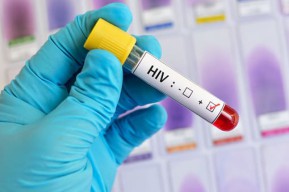 Jumlah Penderita HIV/AIDS di Surabaya Meningkat, Ini Wilayah Terbanyak