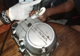 Jari Bocah di Surabaya ini Tak Bisa Keluar dari Mesin Motor, Kok Bisa?