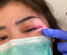 Jadi Korban KDRT, Keponakan Hotman Paris Laporkan Suaminya