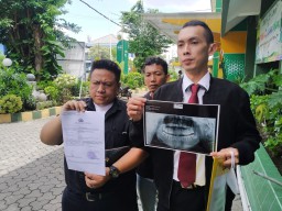 Siswa SMP Petra 5 Surabaya Dianiaya Teman Sekolah, Ayah Lapor Polisi