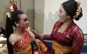 Cerita Gek Resya, Penari Difabel yang Jadi Sorotan di Ajang Forum Tingkat Tinggi ASEAN 2023