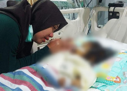 Kisah Nada, Balita 3 Tahun di Probolinggo Berjuang Melawan Penyakit Langka