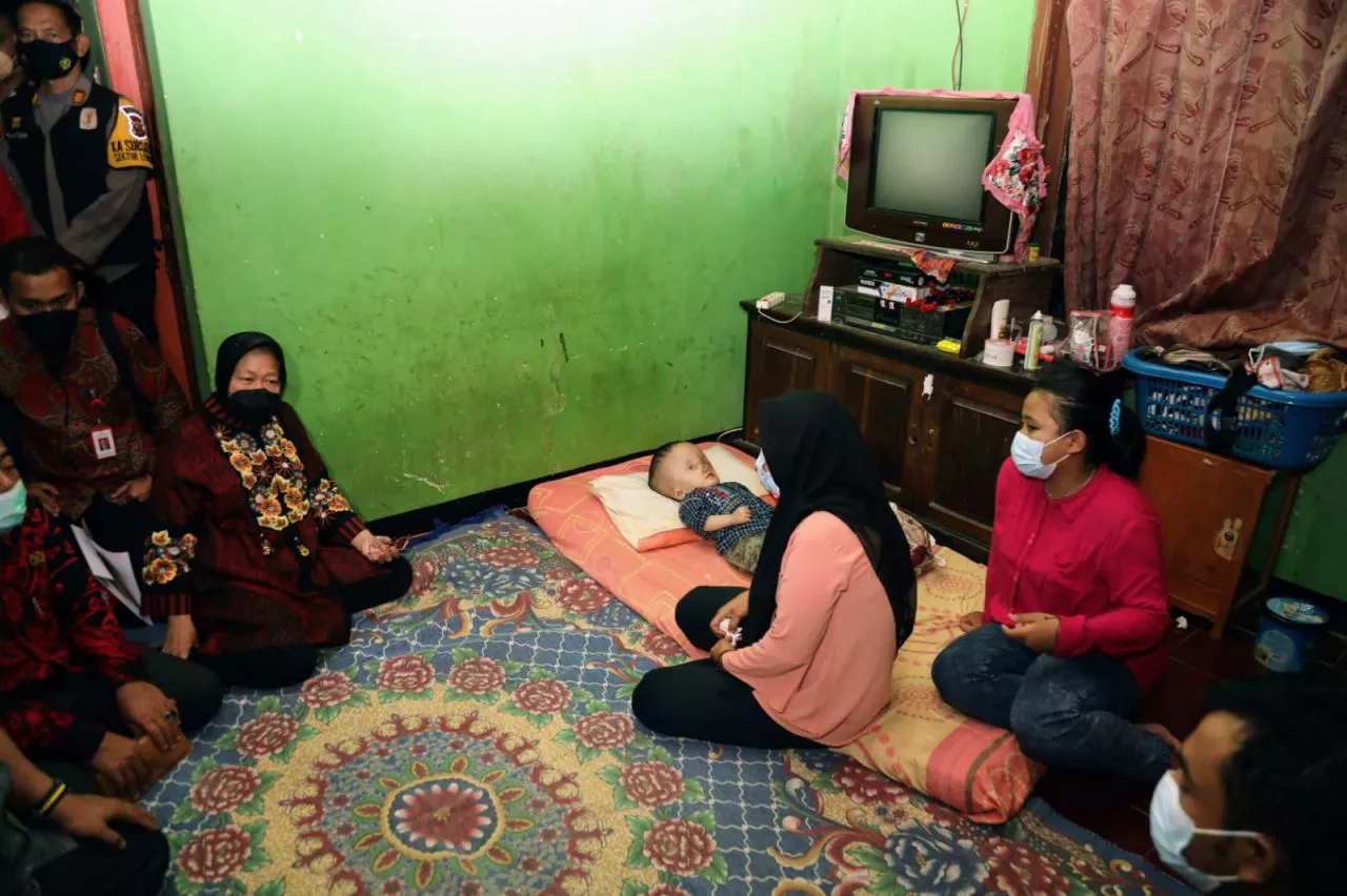 Mensos Risma Bawa Bocah Hidrosefalus Teruskan Pengobatan ke Jakarta