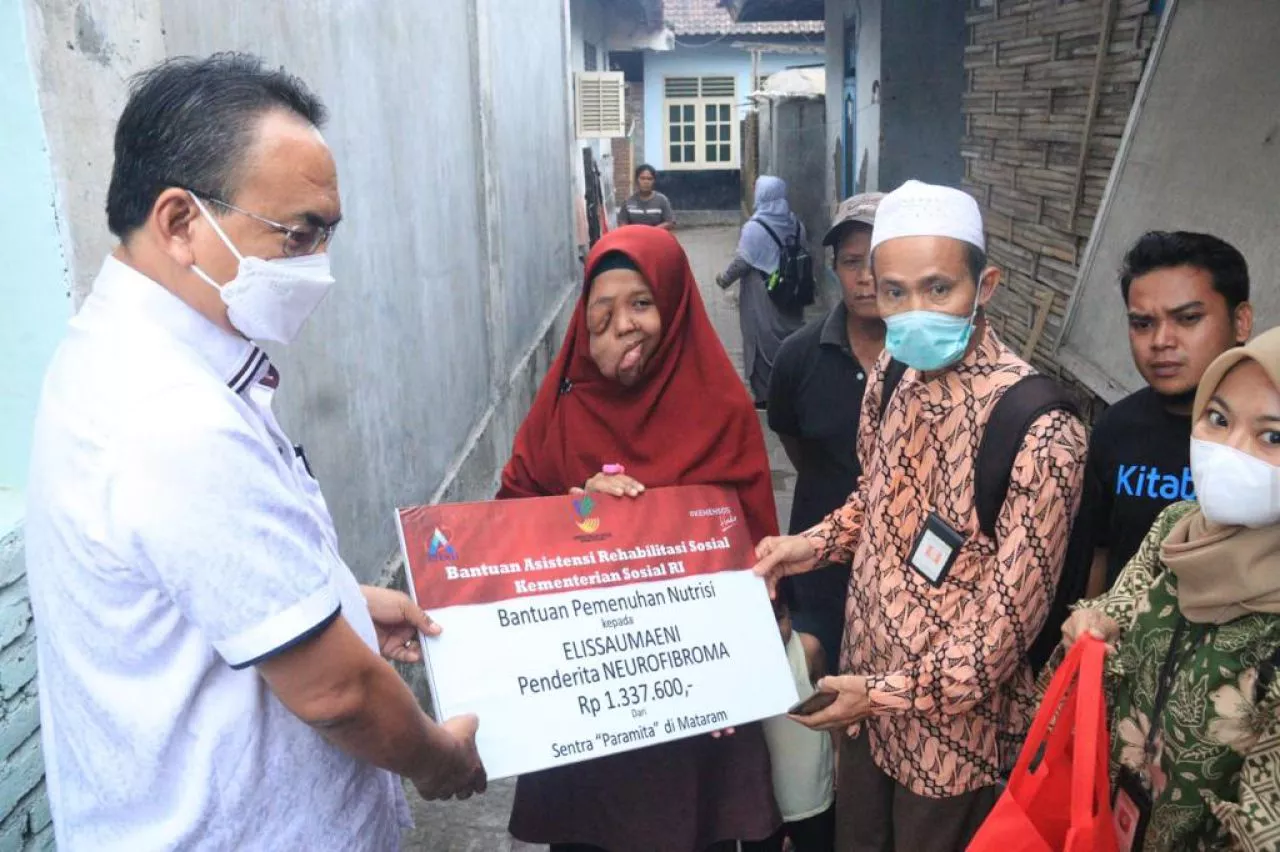 Peduli Penderita Tumor Wajah di Lombok, Kemensos Pastikan Kebutuhan Terpenuhi
