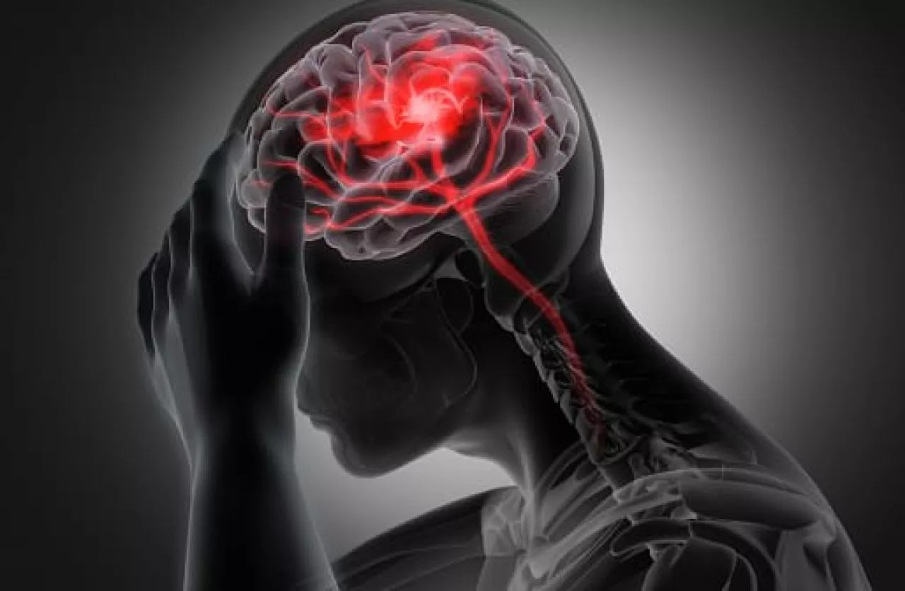 Ini Kata Dokter Unair Soal Pembuluh Darah Indra Bekti Pecah