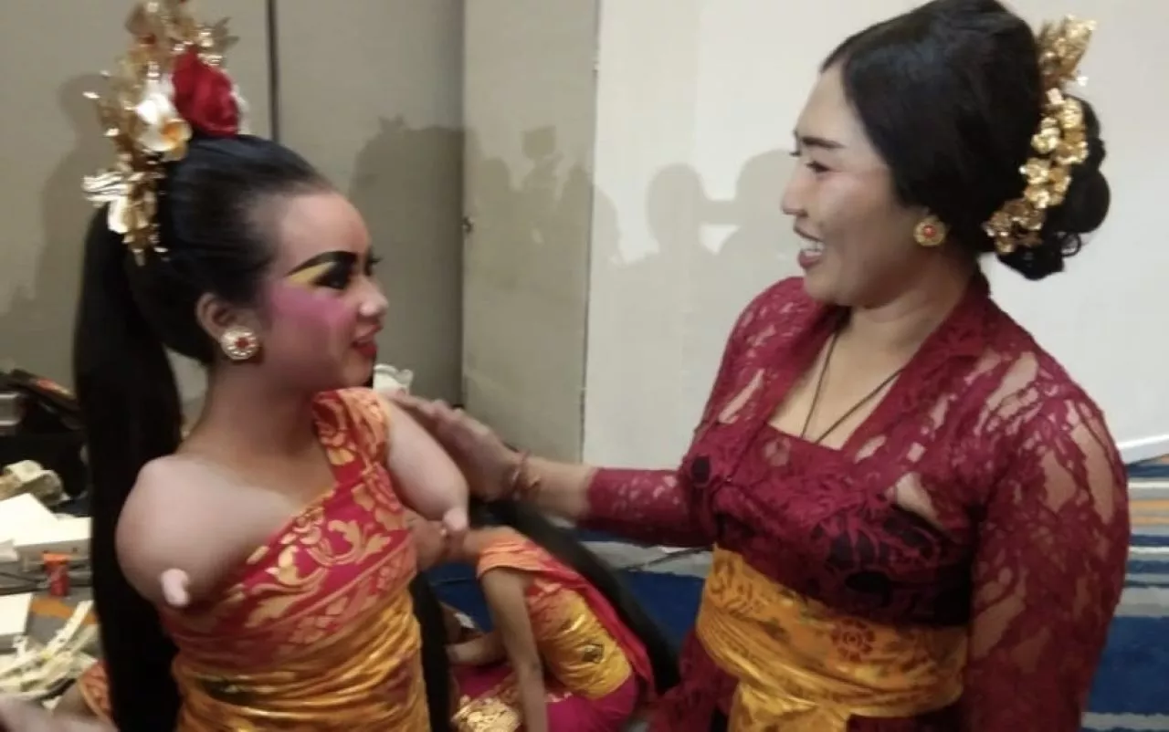 Cerita Gek Resya, Penari Difabel yang Jadi Sorotan di Ajang Forum Tingkat Tinggi ASEAN 2023