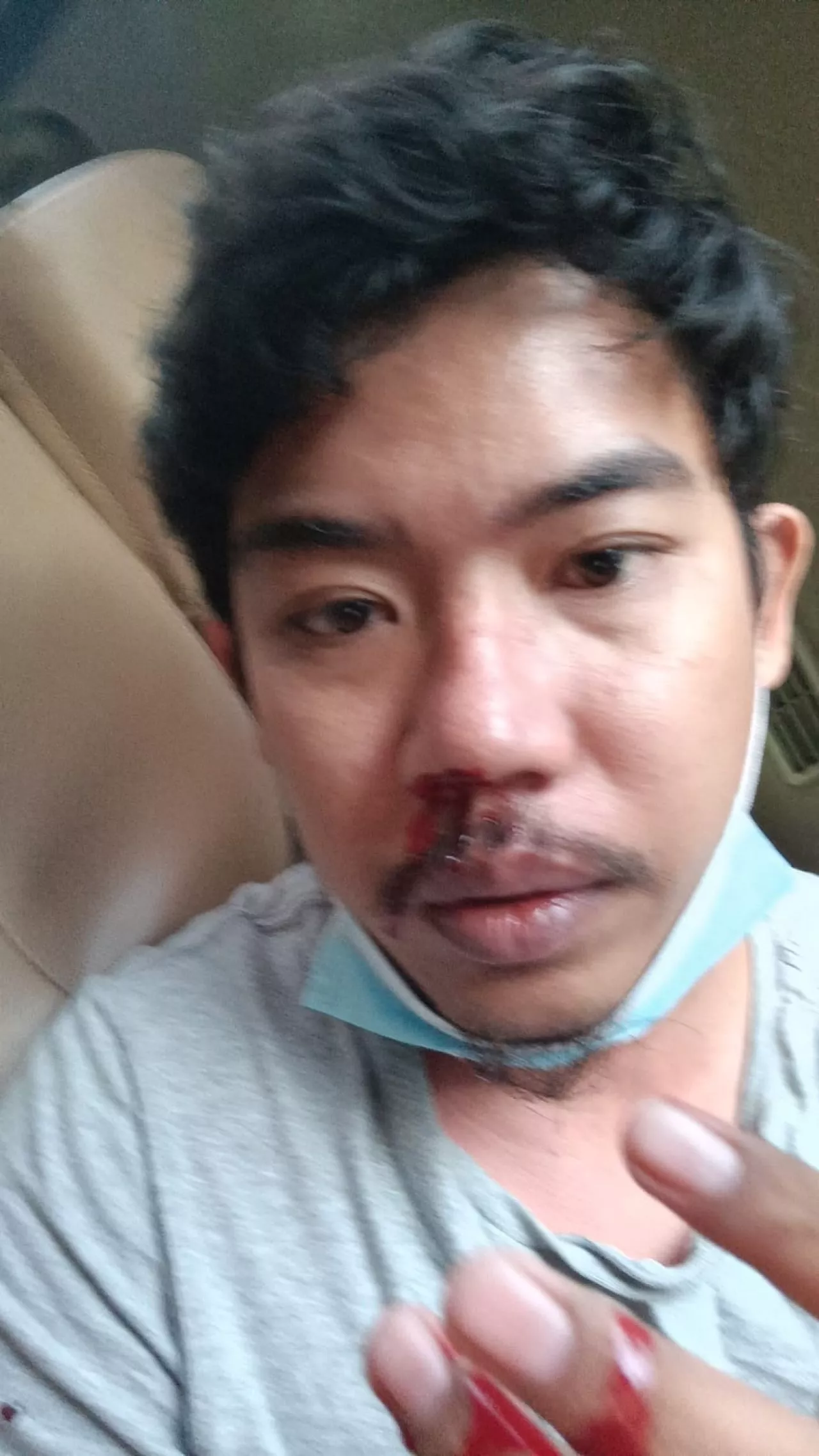 Pemukulan Driver Taksi Online oleh Petugas Parkir Tunjungan Plaza Berakhir Damai